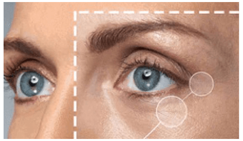 Ingestão de Colágeno: Quais são os benefícios para as articulações?